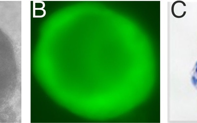 Bronchiale Organoide