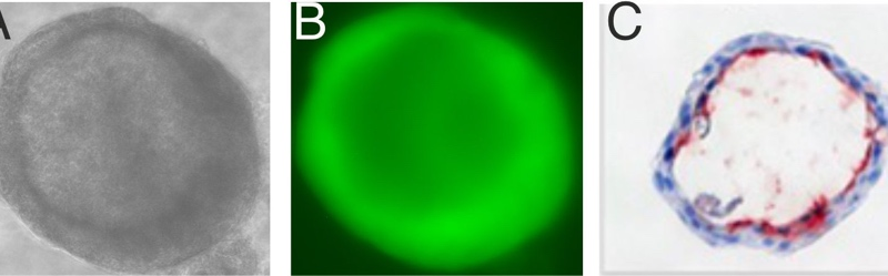 Bronchiale Organoide