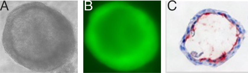 Bronchiale Organoide