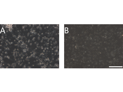 Neuronales In-vitro-Parkinson Disease-Modell