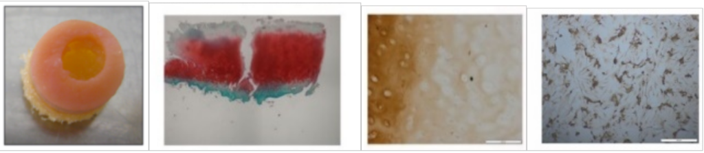 Humane experimentelle osteochondrale Defekte