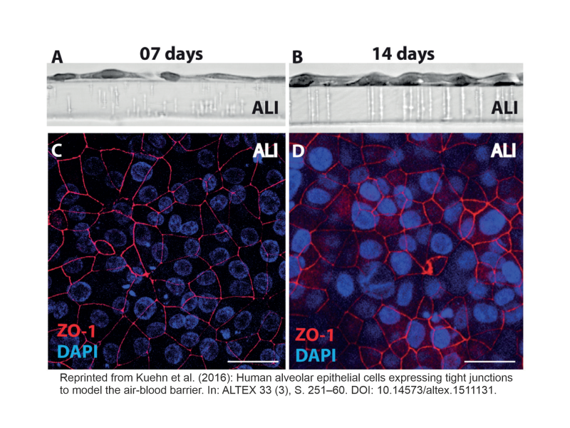 Bronchiale und alveoläre Schleimhaut der Lunge (Luft-Blut-Schranke)