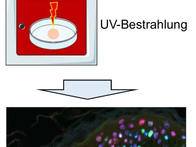 Menschliche Hautbiopsien von Körperspendern als Methode zur Bestimmung fototoxischer Eigenschaften von Medikamenten
